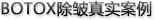 面部除皱优势