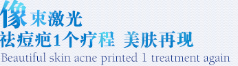 像素激光