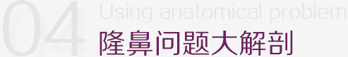 隆鼻问题大解剖